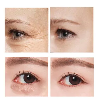 Eemalda silma kotid, silmakreem, retinool koor, anti-puffiness geel, tumedad ringid, viivitus vananemist, vähendab kortse, pinguta ja eemaldada f