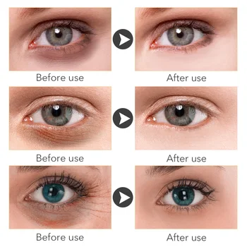 Eemalda silma kotid, silmakreem, retinool koor, anti-puffiness geel, tumedad ringid, viivitus vananemist, vähendab kortse, pinguta ja eemaldada f